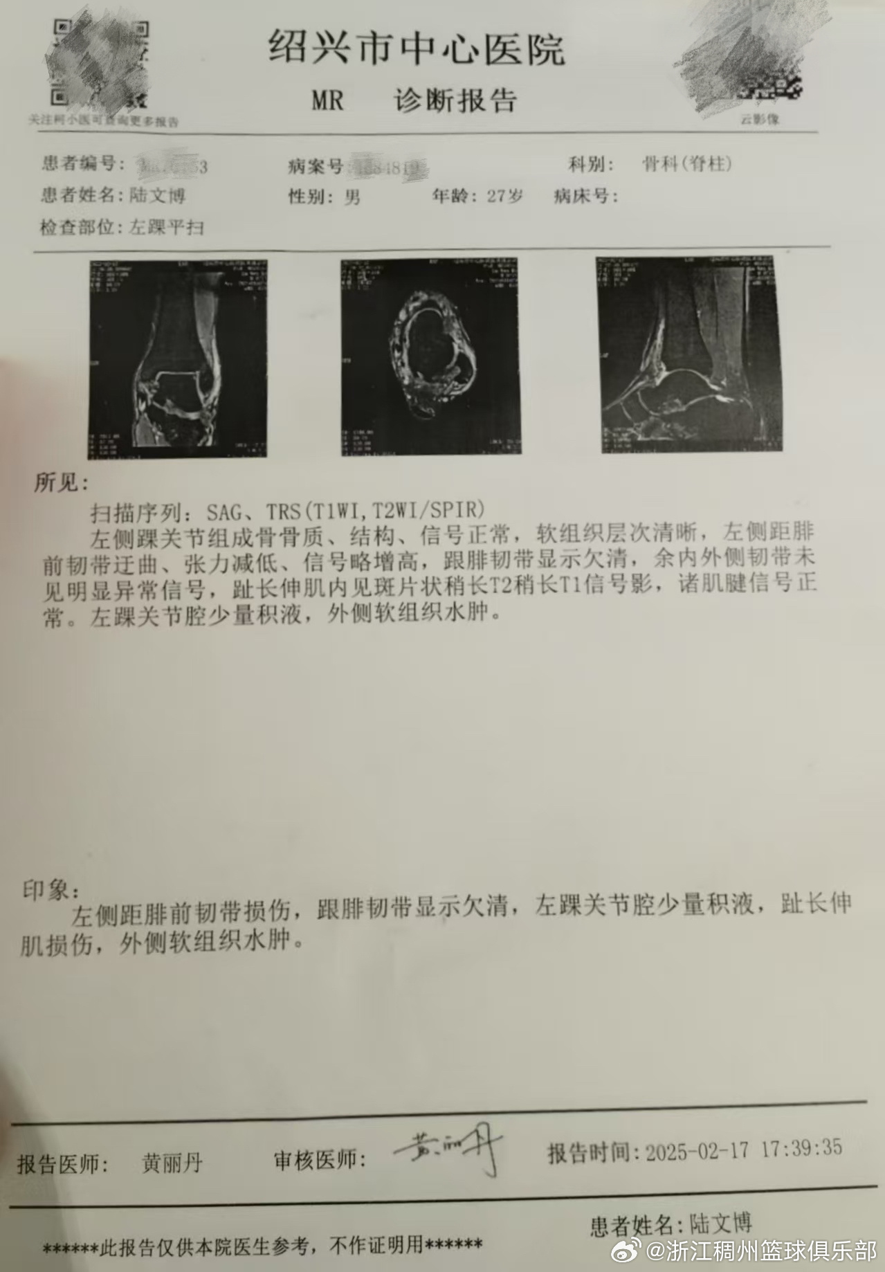 遗憾